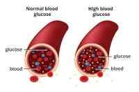 Diabetes & Hypertension